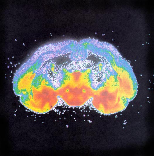 image of opioid receptor density in brain of guinea-pig